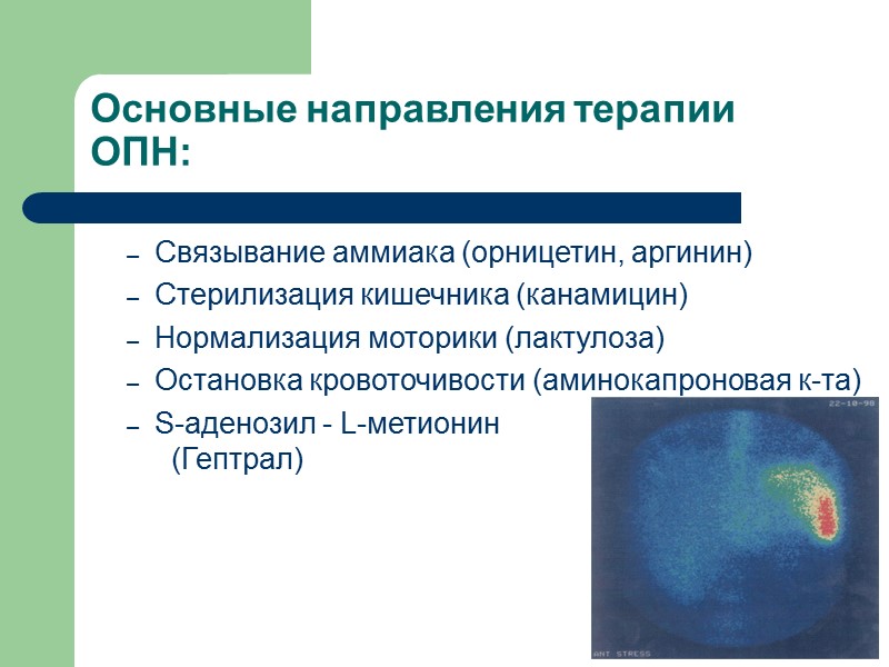 Основные направления терапии ОПН: Связывание аммиака (орницетин, аргинин) Стерилизация кишечника (канамицин) Нормализация моторики (лактулоза)